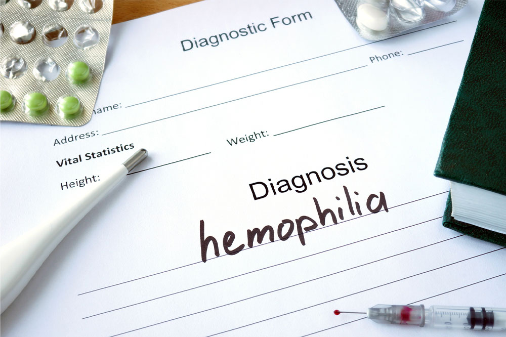 Hemophilia – Its types, symptoms, and management